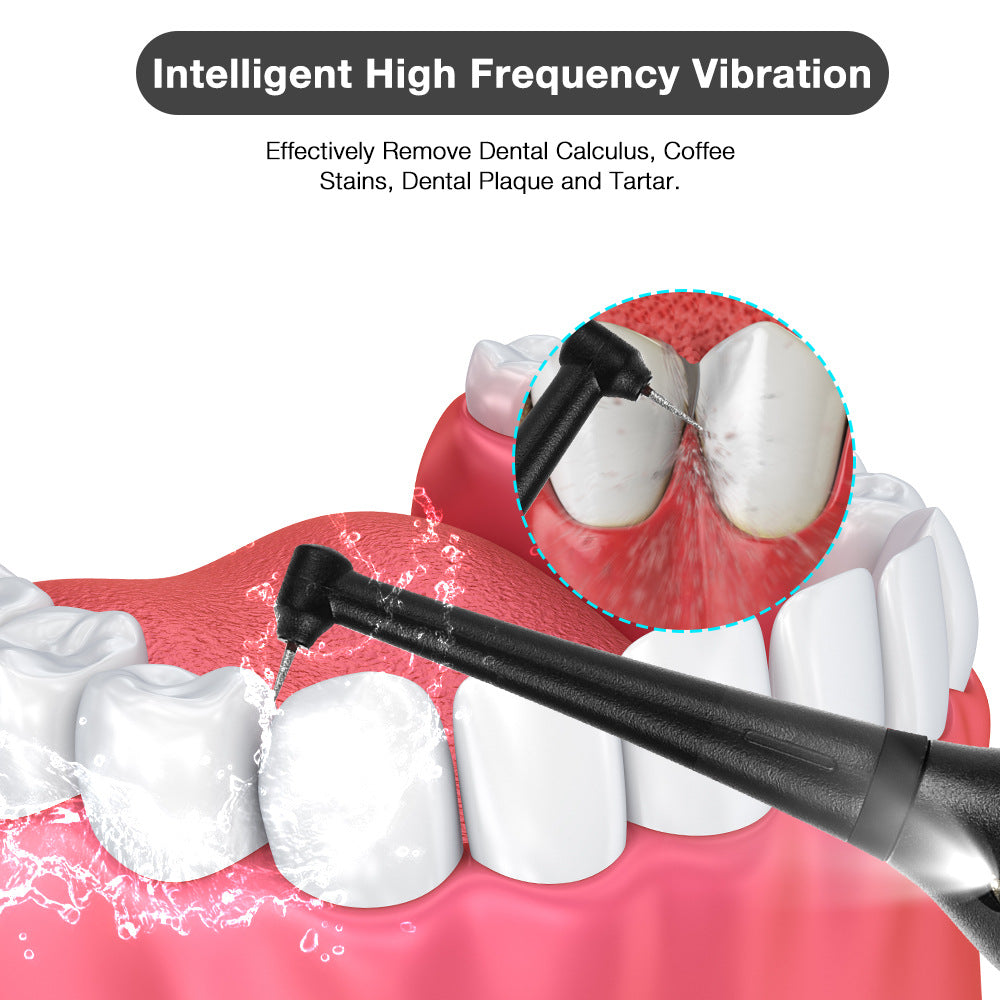 Portable Electric Tooth Scaler Dental Care Tool Adult Beauty Tooth Scaler To Remove Calculus
